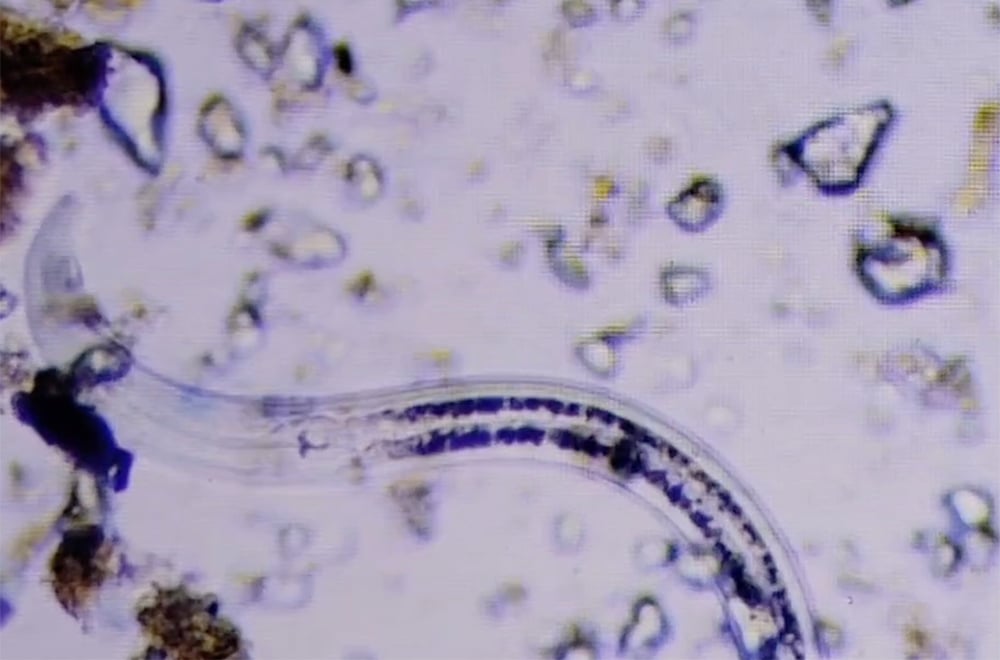 Organic-Insect-Control-for-Gardensbeneficialnematodeweb